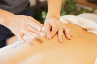 Close Up of Acupuncture