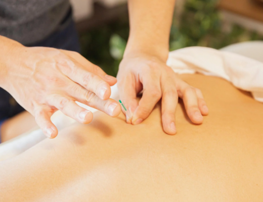 Close Up of Acupuncture